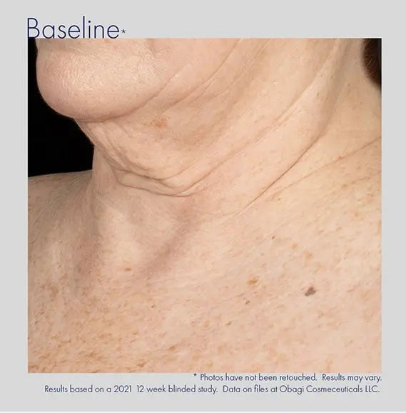 Obagi ELASTIderm Neck and Decollete Concentrate 60ml