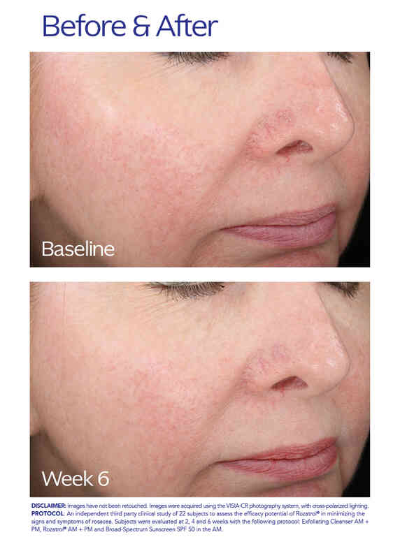 ZO Skin Health Rozatrol®