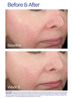 ZO Skin Health Rozatrol®