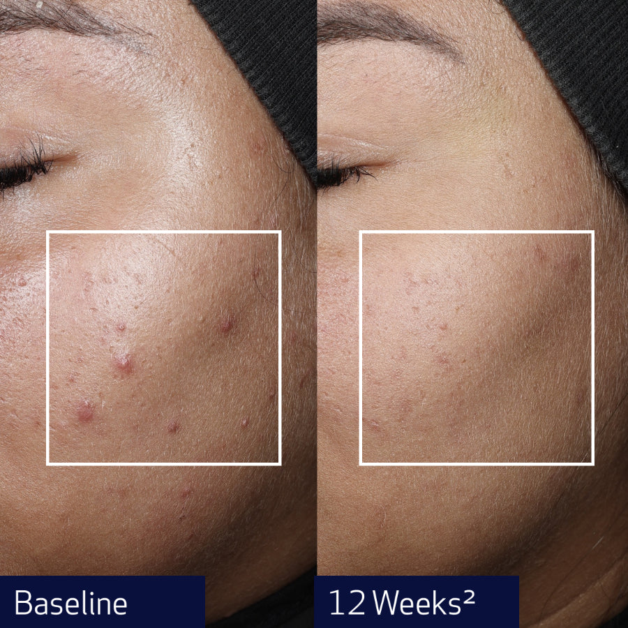OBAGI NU-GEN™ CELLULAR RENEWAL SERUM