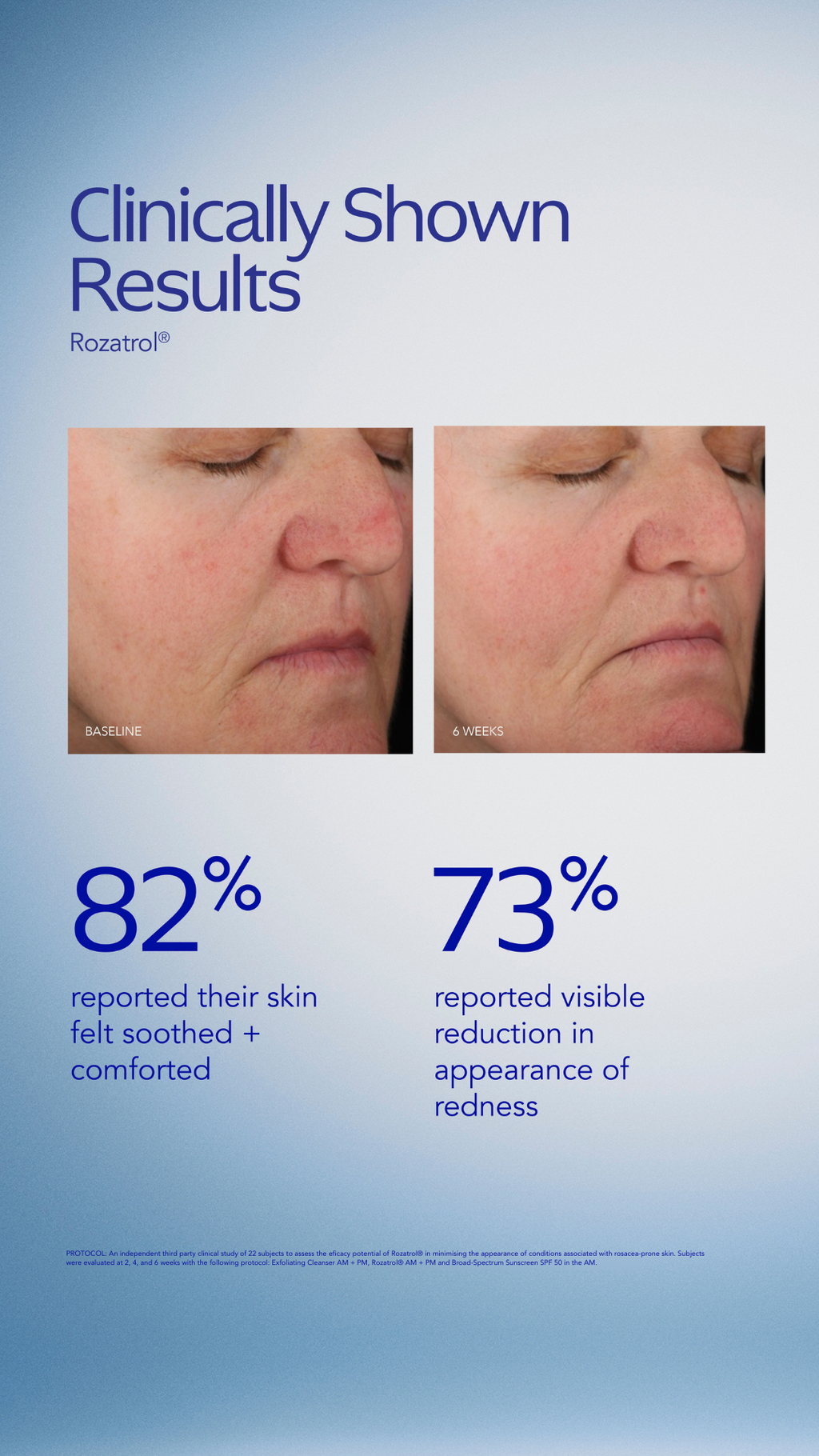 ZO Skin Health Rozatrol®