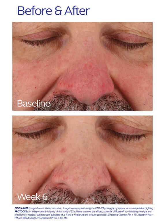 ZO Skin Health Rozatrol®