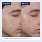 Obagi | CLENZIDERM M.D. Resurfacing Multi-Acid Peel Pads (30 Pads)