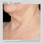 Obagi ELASTIderm Neck and Decollete Concentrate 60ml