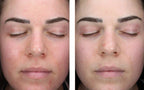 SkinBetter Science AlphaRet Clearing Serum