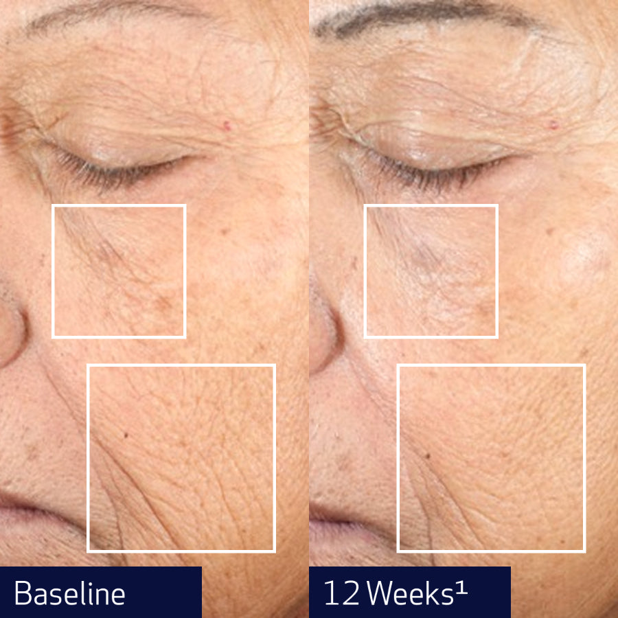 OBAGI NU-GEN™ CELLULAR RENEWAL SERUM