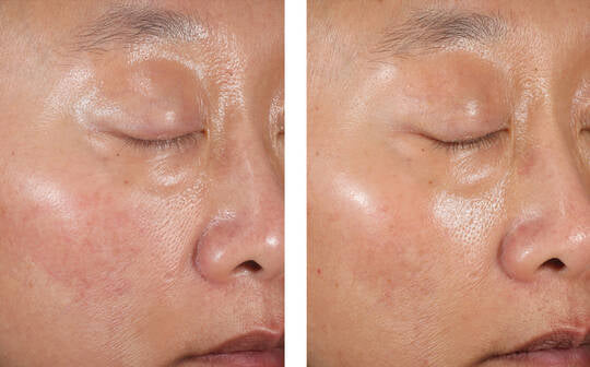 Skinbetter Science A-Team Duo Advanced Kit