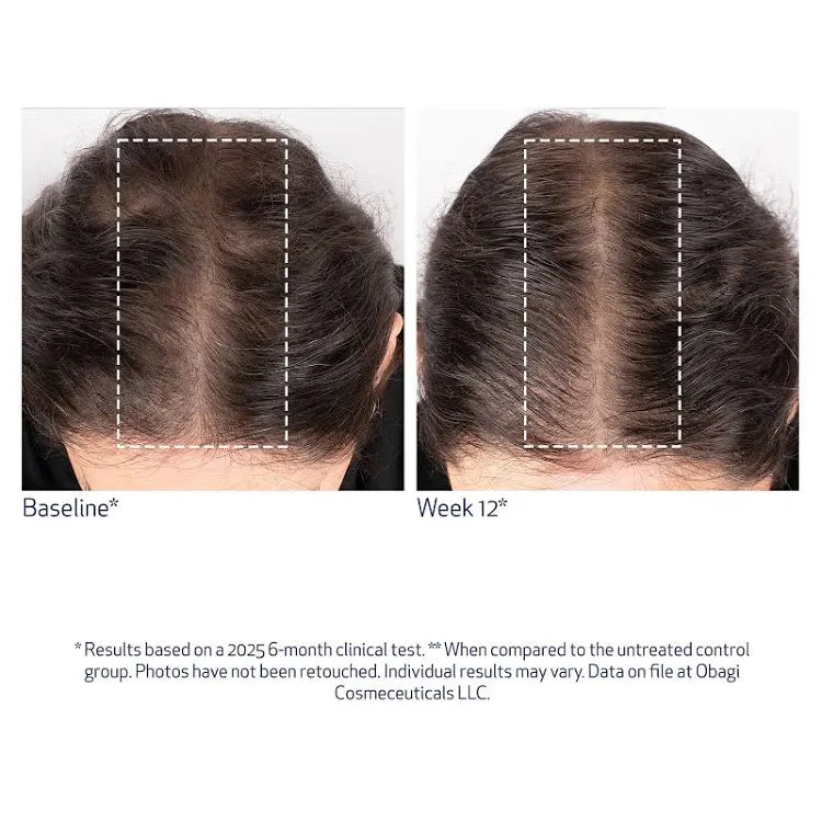 Obagi Nu-Cil BioStim Scalp Serum 60ml