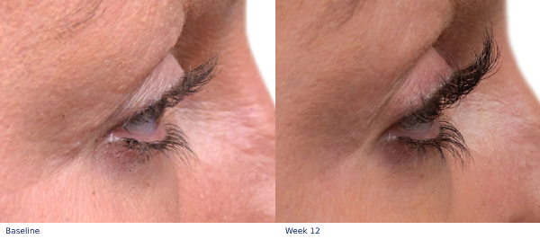 Obagi Nu-Cil Eyelash Enhancing Serum