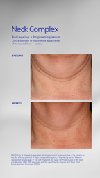 ZO Skin Health Neck Complex Anti-Aging + Brightening Serum 50ml (NEW)