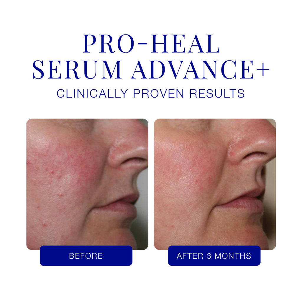 IS Clinical Pro Heal Serum Advance +