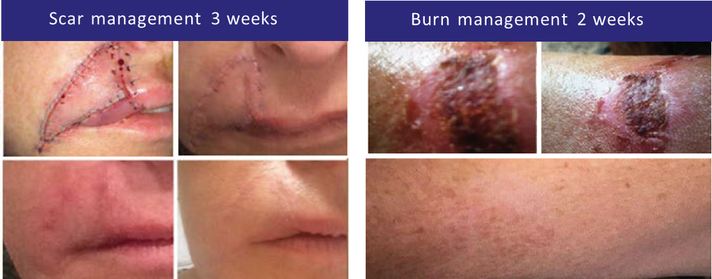 iS Clinical SHEALD Recovery Balm