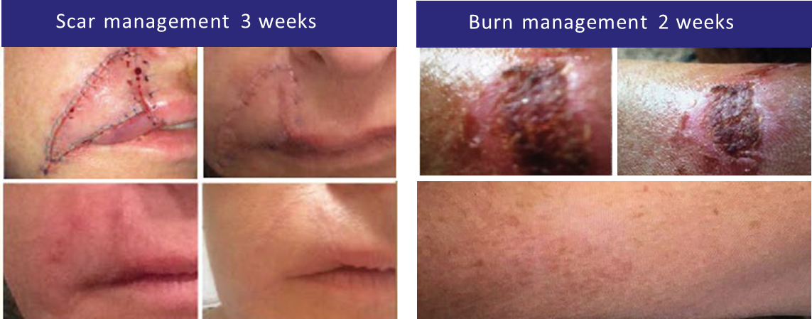 iS Clinical SHEALD Recovery Balm